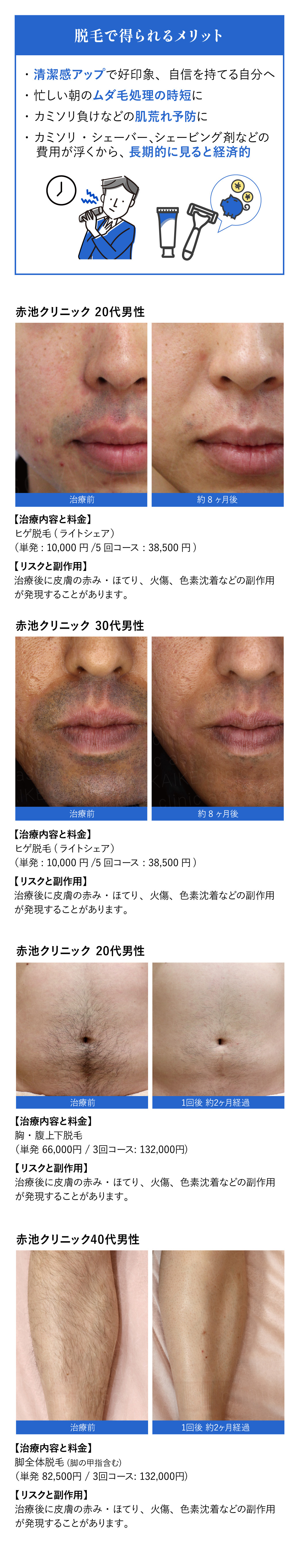 男性の脱毛（ヒゲ脱毛、ボディ脱毛） | 徳島で脱毛するなら赤池クリニック
